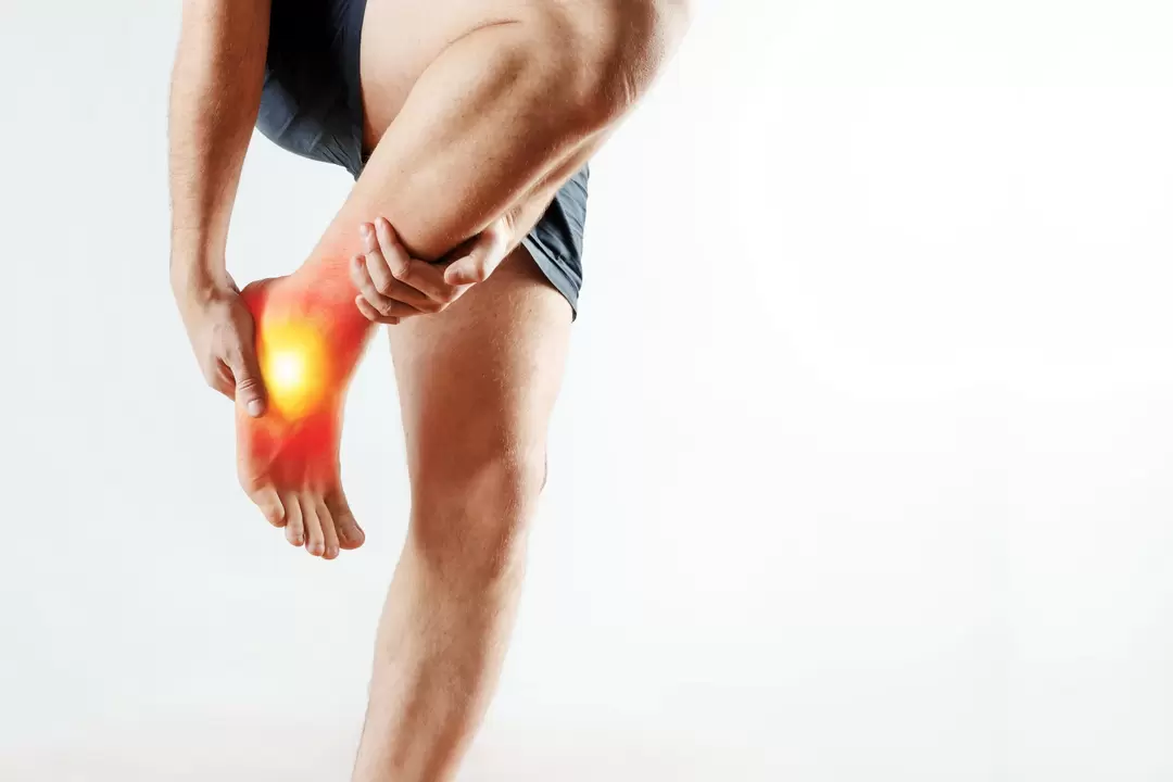 Articolazione e trattamento con Congelum -gel