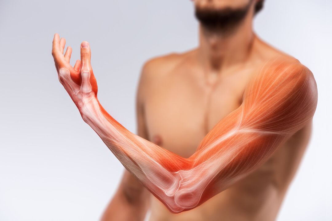 Muscoli manuali e il loro trattamento con trattamento Congelum -gel