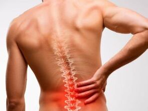Dolore lombare dovuto all'osteocondrosi